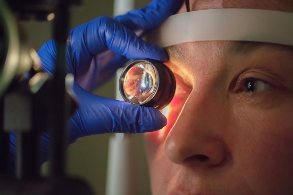 Ophthalmologist performing a detailed eye examination with a diagnostic lens before implantable contact lens surgery.