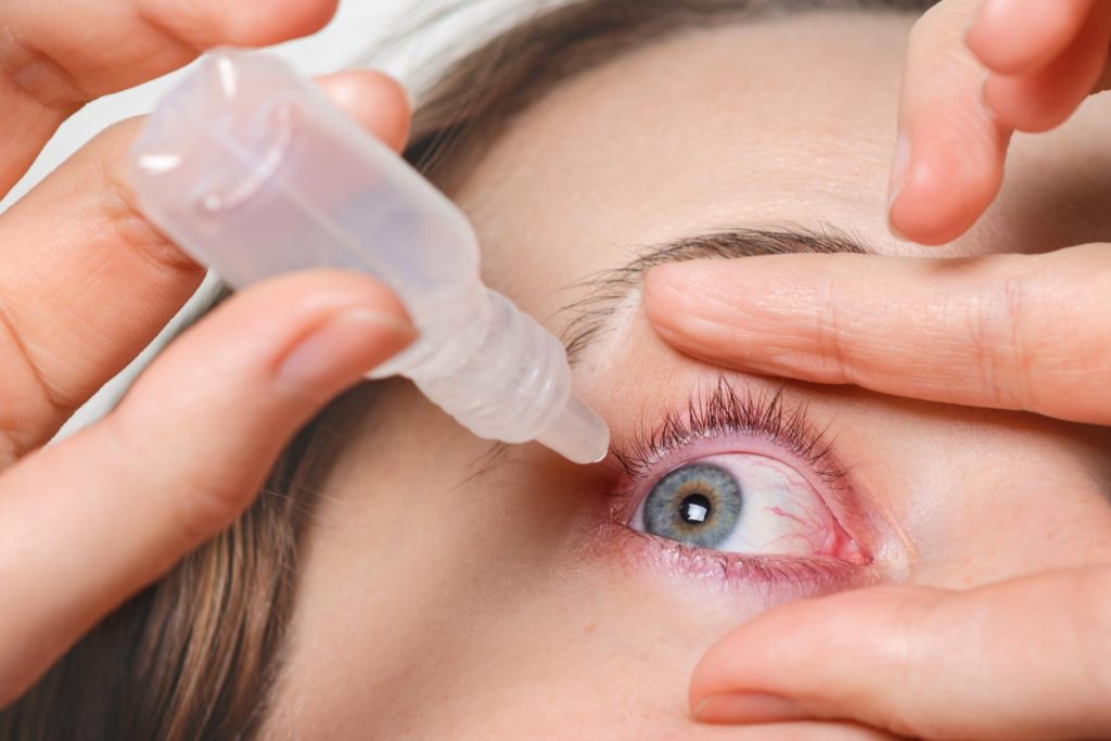 Close-up of a person applying eye drops to soothe irritation and redness caused by pink eye.