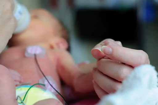Why Premature Babies Have a Higher Amblyopia Risk