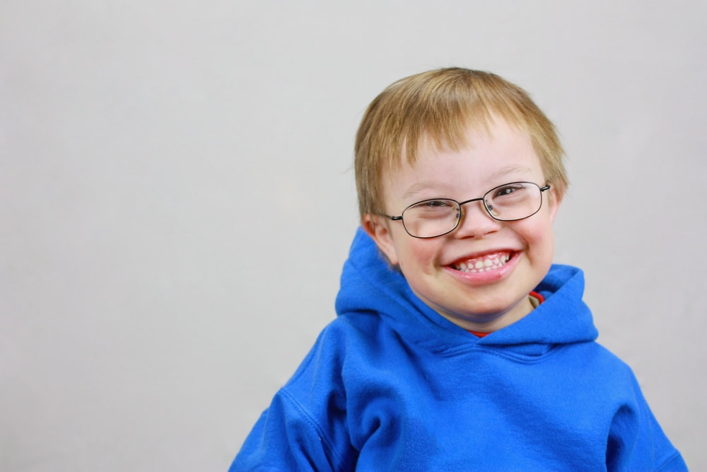 A smiling boy with Down syndrome wears glasses, representing the higher risk of amblyopia in children with Down syndrome and other chromosomal conditions