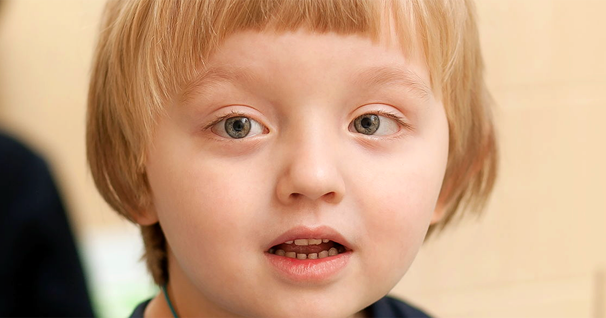 a child with lazy eye
