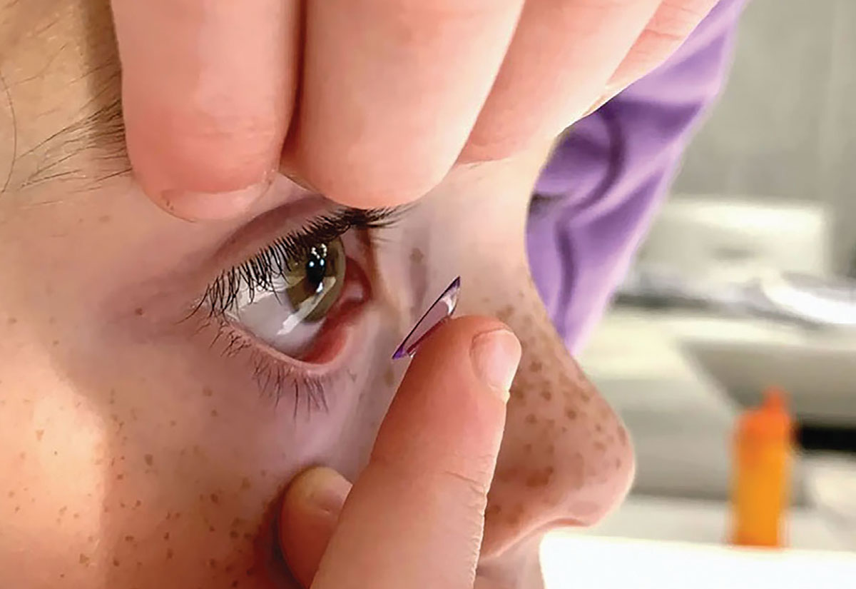 a girl is wearing contact lense