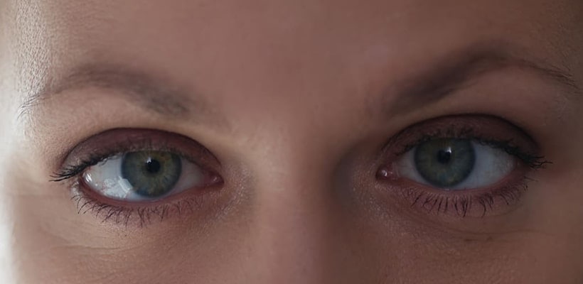 an adult having amblyopia