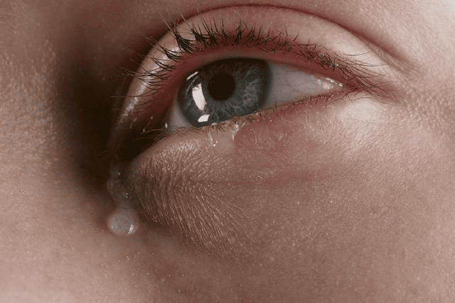 Close-up of a watery, irritated eye with a tear running down the cheek
