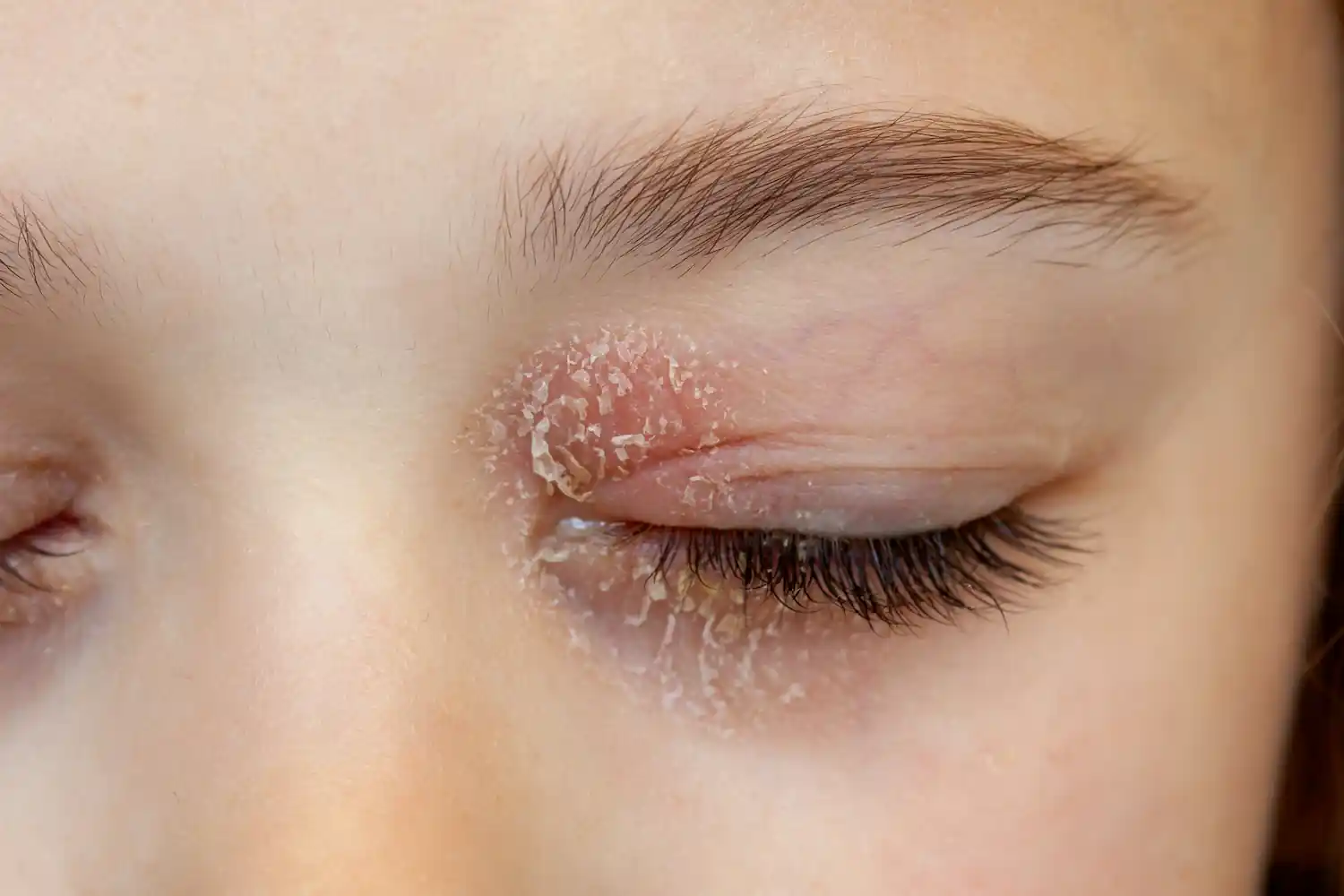Closed eye with shimmery peachy eyeshadow and defined brow