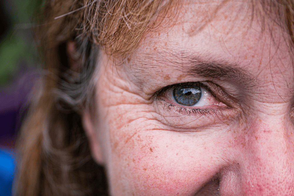 Older person's blue eye with wrinkled skin and freckles