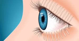 Illustration of a blue eye with visible redness along the eyelid, representing meibomian gland dysfunction