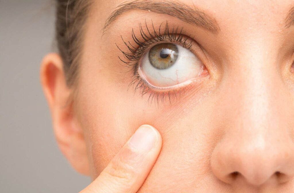 A close-up of a woman pulling down her lower eyelid to reveal a slightly dry, irritated eye.