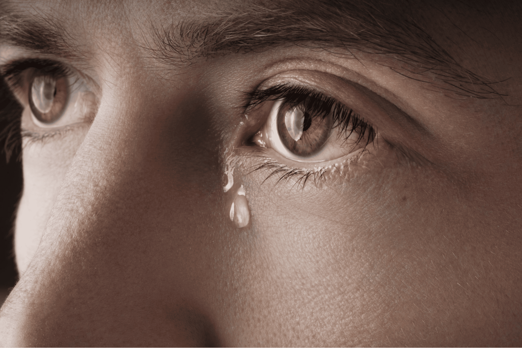 Close-up of a watery eye with a tear rolling down, a common symptom of dry eye disease